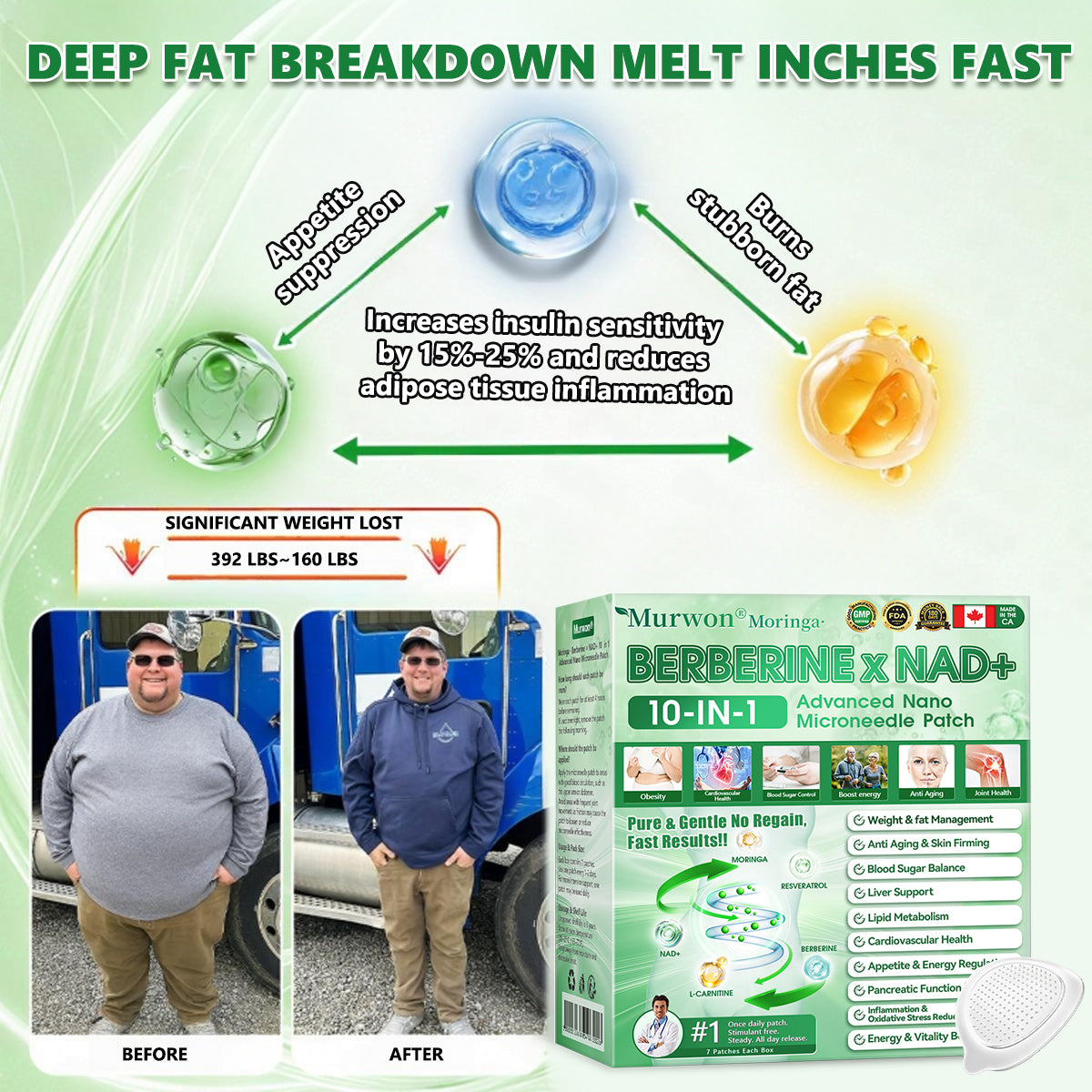 𝑶𝒇𝒇𝒊𝒄𝒊𝒂𝒍 𝒔𝒕𝒐𝒓𝒆  | 🩹𝐌𝐮𝐫𝒘𝒐𝒏® 𝐌𝐨𝐫𝐢𝐧𝒈𝗮 𝑩𝒆𝒓𝒃𝒆𝐫𝐢𝐧𝐞 𝐱 𝐍𝗔𝒟+ 10-𝑖n-1 𝐍a𝒏𝒐 𝐌𝐢𝐜𝐫𝑜𝑛𝑒𝑒𝗱𝗹𝗲 𝐏𝐚𝒕𝒄𝒉🇺🇸(𝐉𝐮𝐬𝐭 𝐨𝐧𝐜𝐞 𝐚 𝐝𝐚𝐲, 𝐯𝐢𝐬𝐢𝐛𝐥𝐞 𝐜𝐡𝐚𝐧𝐠𝐞𝐬 𝐢𝐧 𝟕 𝑫𝐚𝐲𝐬） ✅ 𝐅𝐨𝐫 𝐎𝐛𝐞𝐬𝐢𝐭𝐲,  𝙇𝙊𝙊𝙎𝗘 𝗦𝗞𝗜𝗡,𝐝𝐢𝐚𝐛𝐞𝐭𝙚𝙨, 𝐬𝐥𝐞𝐞𝐏 𝐚𝐩𝐧𝐞𝐚, 𝐣𝐨𝐢𝐧𝐭 𝐢𝐬𝐬𝐮𝙚𝙨, 𝐚𝐧𝐝 𝐦𝐨𝐫𝐞