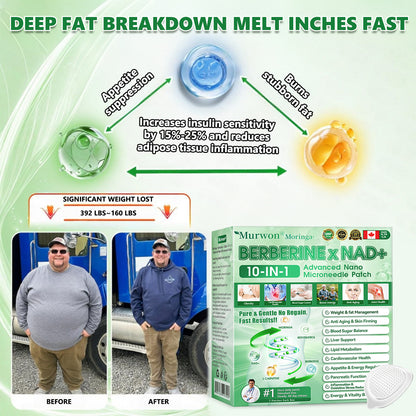 𝑶𝒇𝒇𝒊𝒄𝒊𝒂𝒍 𝒔𝒕𝒐𝒓𝒆  | 🩹𝐌𝐮𝐫𝒘𝒐𝒏® 𝐌𝐨𝐫𝐢𝐧𝒈𝗮 𝑩𝒆𝒓𝒃𝒆𝐫𝐢𝐧𝐞 𝐱 𝐍𝗔𝒟+ 10-𝑖n-1 𝐍a𝒏𝒐 𝐌𝐢𝐜𝐫𝑜𝑛𝑒𝑒𝗱𝗹𝗲 𝐏𝐚𝒕𝒄𝒉🇺🇸(𝐉𝐮𝐬𝐭 𝐨𝐧𝐜𝐞 𝐚 𝐝𝐚𝐲, 𝐯𝐢𝐬𝐢𝐛𝐥𝐞 𝐜𝐡𝐚𝐧𝐠𝐞𝐬 𝐢𝐧 𝟕 𝑫𝐚𝐲𝐬） ✅ 𝐅𝐨𝐫 𝐎𝐛𝐞𝐬𝐢𝐭𝐲,  𝙇𝙊𝙊𝙎𝗘 𝗦𝗞𝗜𝗡,𝐝𝐢𝐚𝐛𝐞𝐭𝙚𝙨, 𝐬𝐥𝐞𝐞𝐏 𝐚𝐩𝐧𝐞𝐚, 𝐣𝐨𝐢𝐧𝐭 𝐢𝐬𝐬𝐮𝙚𝙨, 𝐚𝐧𝐝 𝐦𝐨𝐫𝐞