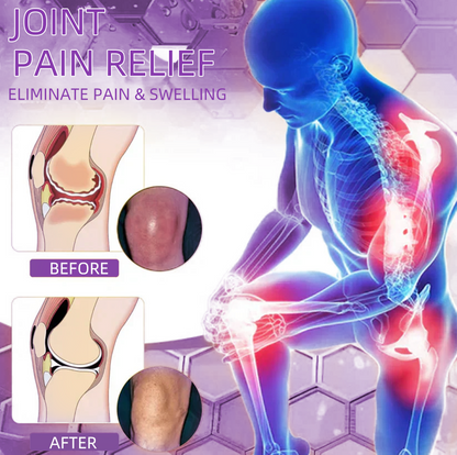 Official Store: 𝑴𝒖𝒓𝒘𝒐𝒏®  Shark Cartilage Pain Relief Bone Recovery Gel 🔥Limited time offer, enjoy 30% off the second item again