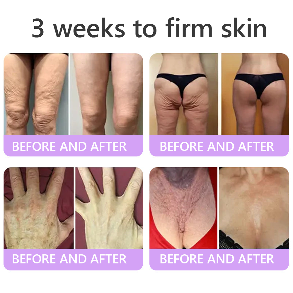 𝐃𝐞𝐫𝐦𝐚𝐭𝐨𝐥𝐨𝐠𝐢𝐬𝐭-𝐑𝐞𝐜𝐨𝐦𝐦𝐞𝐧𝐝𝐞𝐝 👩‍⚕️|💕 𝑽𝒊𝙩𝙖l𝗶𝘀𝐲𝐬® 𝙋𝘿𝙍𝙉 𝙈𝙪𝙡𝙩𝙞-𝙋𝙚𝙥𝙩𝙞𝙙𝙚 𝑴𝒂𝒔𝒔𝒂𝒈𝒊𝒏𝒈 𝑩𝒐𝒅𝒚 𝑹𝒐𝒍𝒍𝒆𝒓 𝑪𝒓𝒆𝒂𝒎- 𝑨𝒏𝒕𝒊-𝒂𝒈𝒊𝒏𝒈, 𝐇𝐲𝐝𝐫𝐚𝐭𝐢𝐧𝐠, 𝐒𝐤𝐢𝐧 𝐅𝐢𝐫𝐦𝐢𝐧𝐠 & 𝐋𝐢𝐟𝐭𝐢𝐧𝐠, 𝗦𝗸𝗶𝗻 𝗥𝗲𝗽𝗮𝗶𝗿, 𝗘𝘃𝗲𝗻 𝗧𝗼𝗻𝗲, 𝗔𝗰𝗻𝗲 𝗮𝗻𝗱 𝗗𝗮𝗿𝗸 𝗦𝗽𝗼𝘁 𝗧𝗿𝗲𝗮𝘁𝗺𝗲𝗻𝘁, 𝗪𝗮𝗿𝘁 𝗮𝗻𝗱 𝗠𝗼𝗹𝗲 𝗥𝗲𝗺𝗼𝘃𝗮𝗹, 𝗮𝗻𝗱 𝗣𝘀𝗼𝗿𝗶𝗮𝘀𝗶𝘀 𝗥𝗲𝗹𝗶𝗲𝗳.