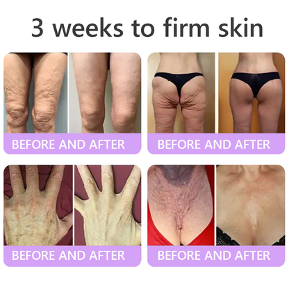 𝐃𝐞𝐫𝐦𝐚𝐭𝐨𝐥𝐨𝐠𝐢𝐬𝐭-𝐑𝐞𝐜𝐨𝐦𝐦𝐞𝐧𝐝𝐞𝐝 👩‍⚕️|💕 𝑽𝒊𝙩𝙖l𝗶𝘀𝐲𝐬® 𝙋𝘿𝙍𝙉 𝙈𝙪𝙡𝙩𝙞-𝙋𝙚𝙥𝙩𝙞𝙙𝙚 𝑴𝒂𝒔𝒔𝒂𝒈𝒊𝒏𝒈 𝑩𝒐𝒅𝒚 𝑹𝒐𝒍𝒍𝒆𝒓 𝑪𝒓𝒆𝒂𝒎- 𝑨𝒏𝒕𝒊-𝒂𝒈𝒊𝒏𝒈, 𝐇𝐲𝐝𝐫𝐚𝐭𝐢𝐧𝐠, 𝐒𝐤𝐢𝐧 𝐅𝐢𝐫𝐦𝐢𝐧𝐠 & 𝐋𝐢𝐟𝐭𝐢𝐧𝐠, 𝗦𝗸𝗶𝗻 𝗥𝗲𝗽𝗮𝗶𝗿, 𝗘𝘃𝗲𝗻 𝗧𝗼𝗻𝗲, 𝗔𝗰𝗻𝗲 𝗮𝗻𝗱 𝗗𝗮𝗿𝗸 𝗦𝗽𝗼𝘁 𝗧𝗿𝗲𝗮𝘁𝗺𝗲𝗻𝘁, 𝗪𝗮𝗿𝘁 𝗮𝗻𝗱 𝗠𝗼𝗹𝗲 𝗥𝗲𝗺𝗼𝘃𝗮𝗹, 𝗮𝗻𝗱 𝗣𝘀𝗼𝗿𝗶𝗮𝘀𝗶𝘀 𝗥𝗲𝗹𝗶𝗲𝗳.